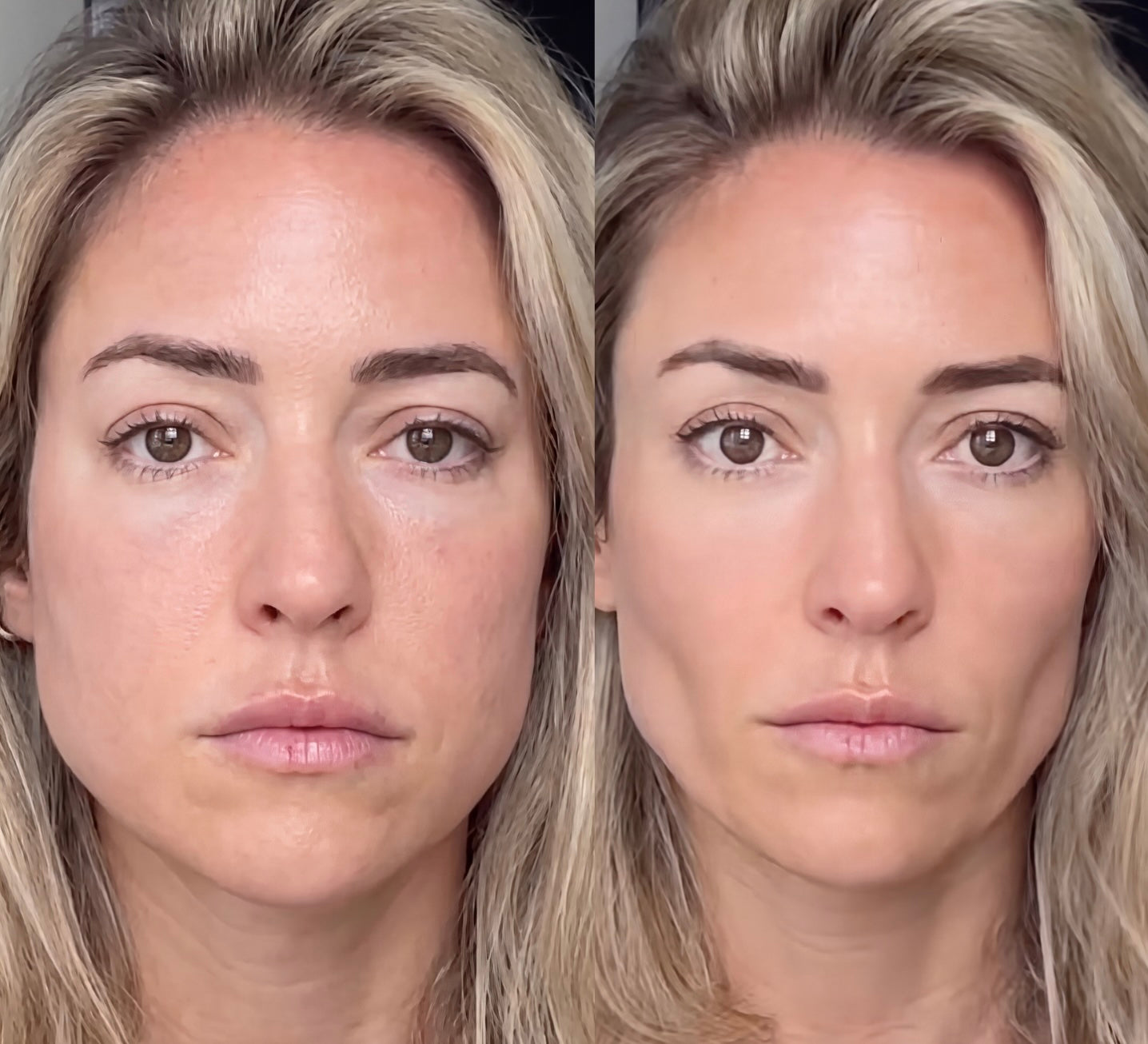 LYFTA Face Slimming Gua Sha Cream